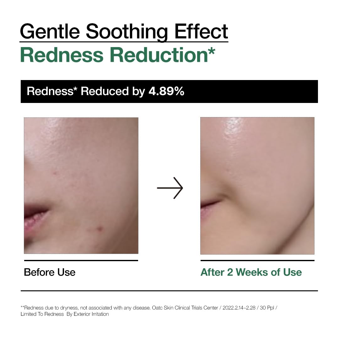 Anua Heartleaf 80+ Moisture Soothing Ampoule