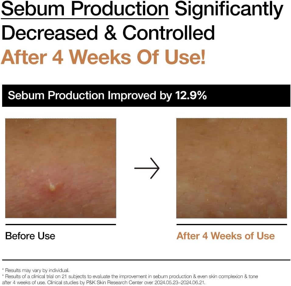 Anua Rice70+Ceramide Glow Milky Toner