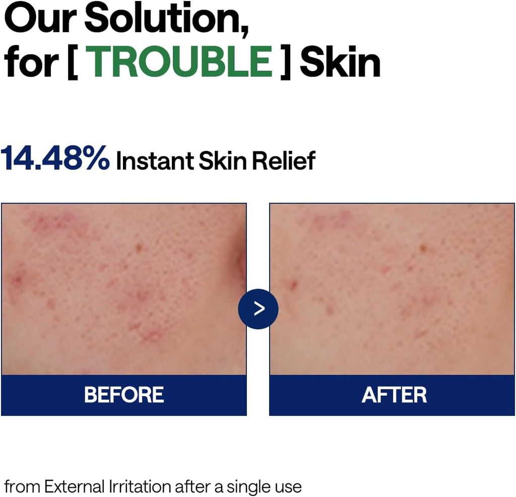 Mediheal Teatree Calming Hydra Serum