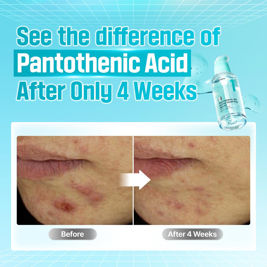 Numbuzin Pantothenic B5 Active Soothing Serum