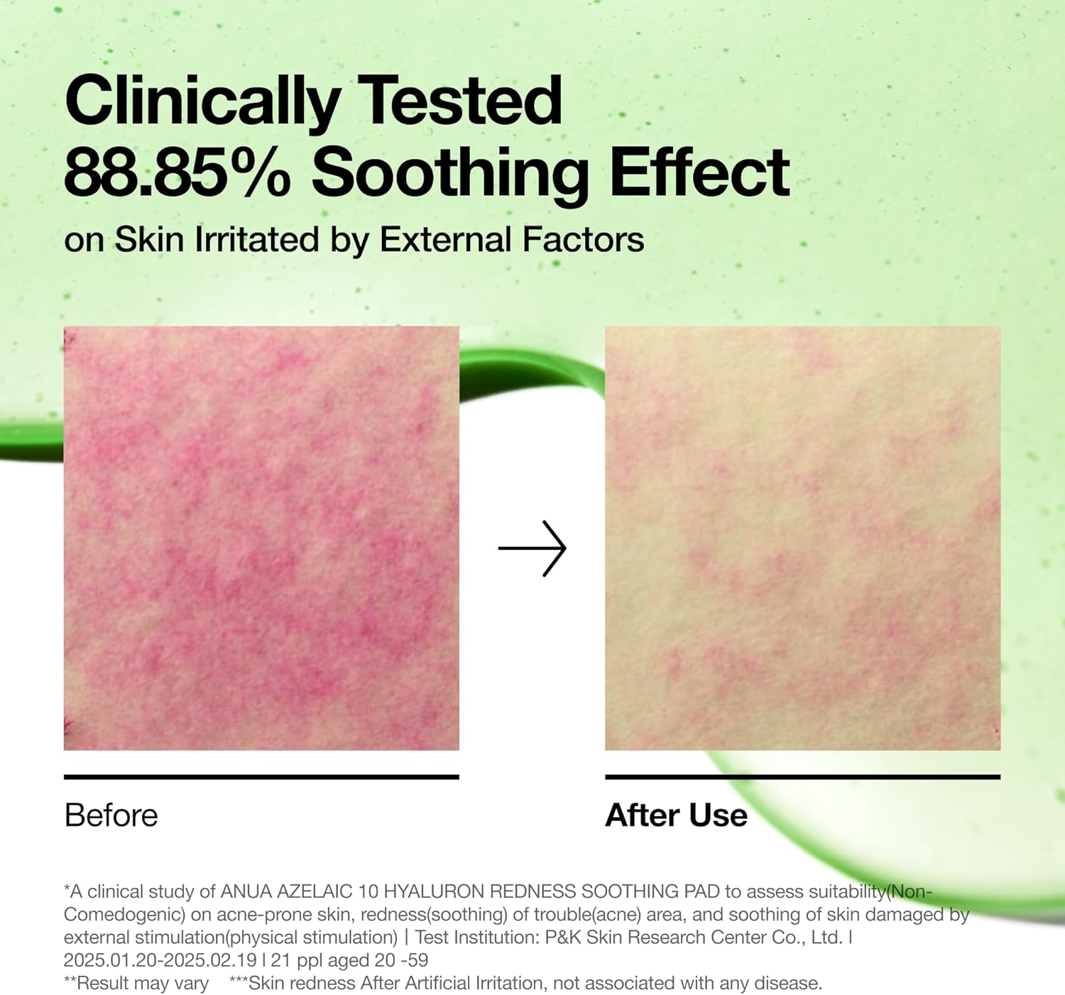 Anua Azelaic 10 Hyaluron Redness Soothing Pad