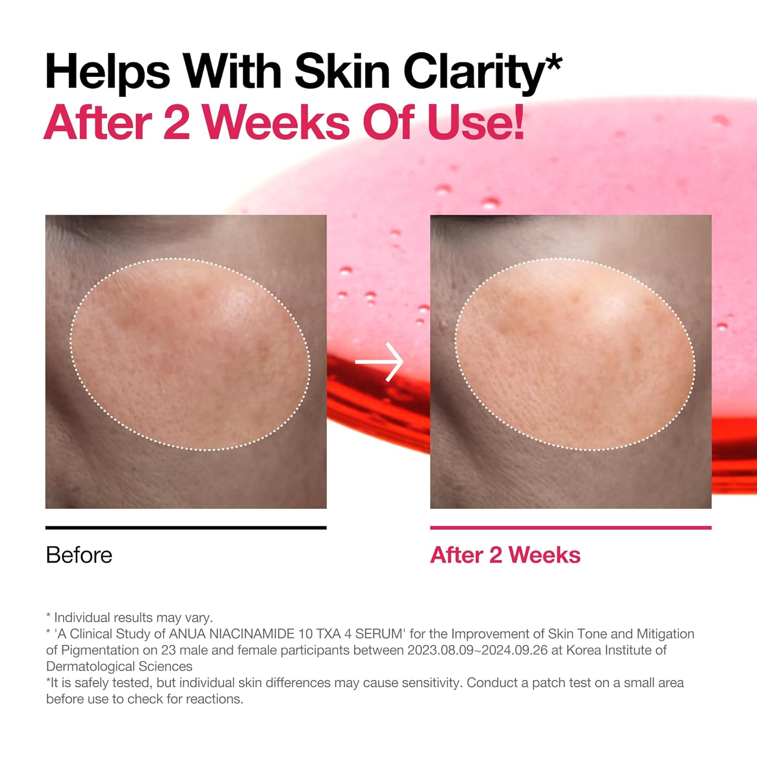 Anua Niacinamide 10%+ TXA 4 Serum